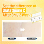 NUMBUZIN Glutathione Vitamin-Niacinamide Pad
