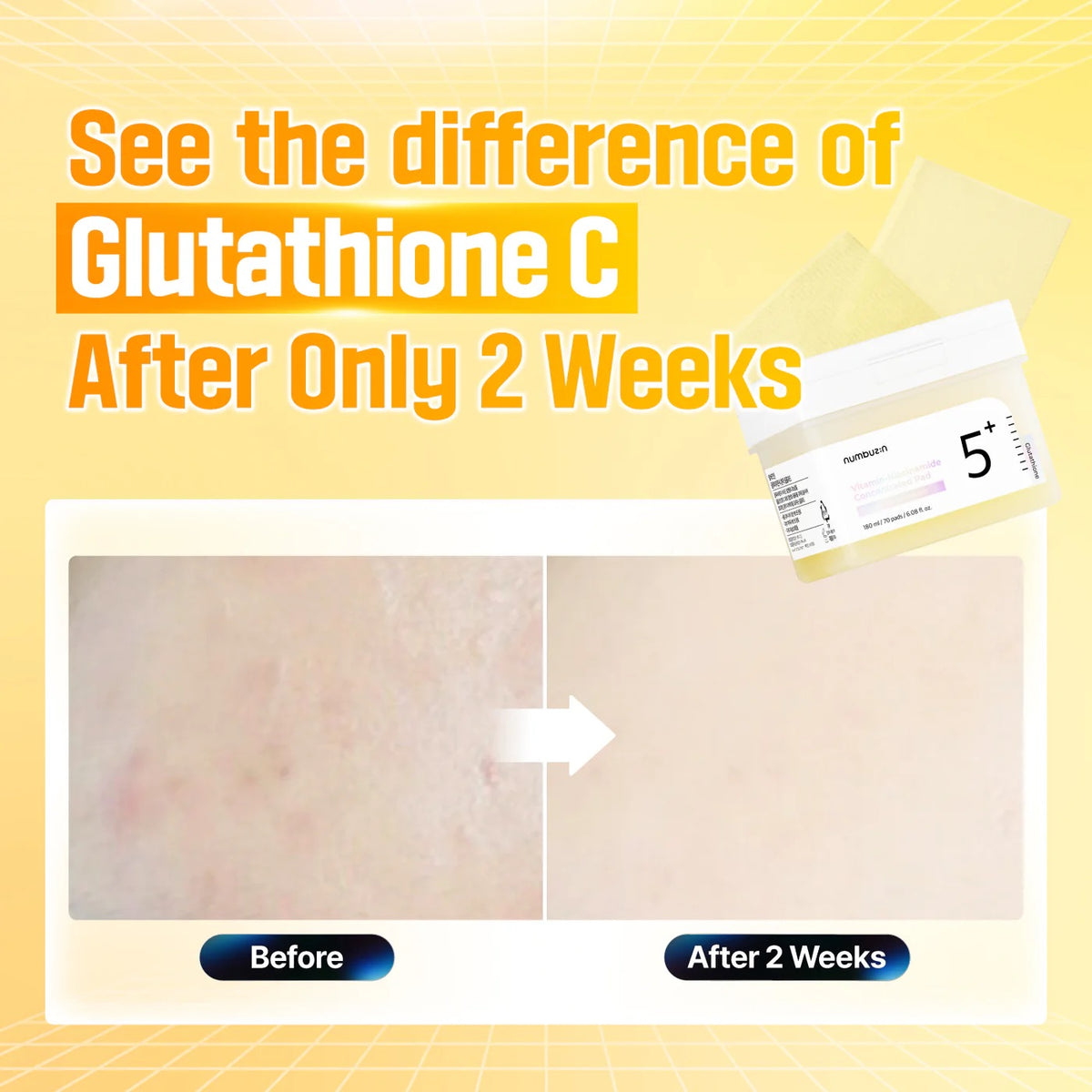 NUMBUZIN Glutathione Vitamin-Niacinamide Pad