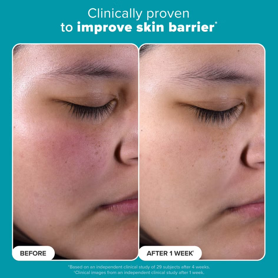 PAULA’S CHOICE 2% BHA Exfoliating Toner