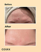 Cosrx Advanced Snail 96 Mucin Essence