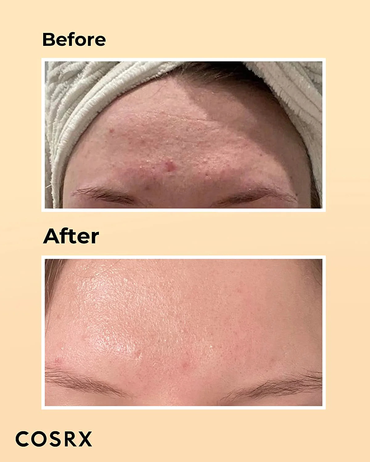 Cosrx Advanced Snail 96 Mucin Essence
