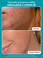 PAULA’S CHOICE 2% BHA Exfoliating Toner