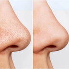 ANUA Deep Cleansing Foam