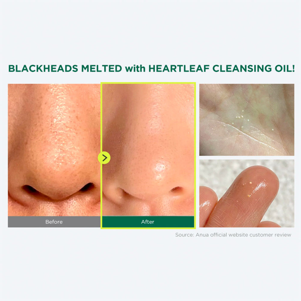 ANUA Heartleaf Pore Cleansing Oil