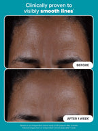 PAULA’S CHOICE 2% BHA Exfoliating Toner