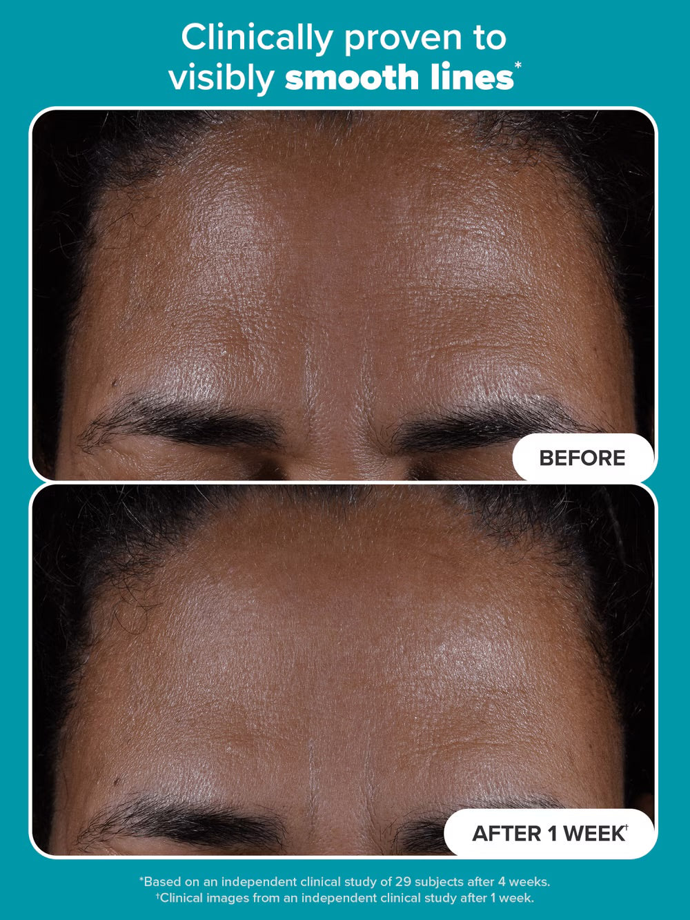 PAULA’S CHOICE 2% BHA Exfoliating Toner
