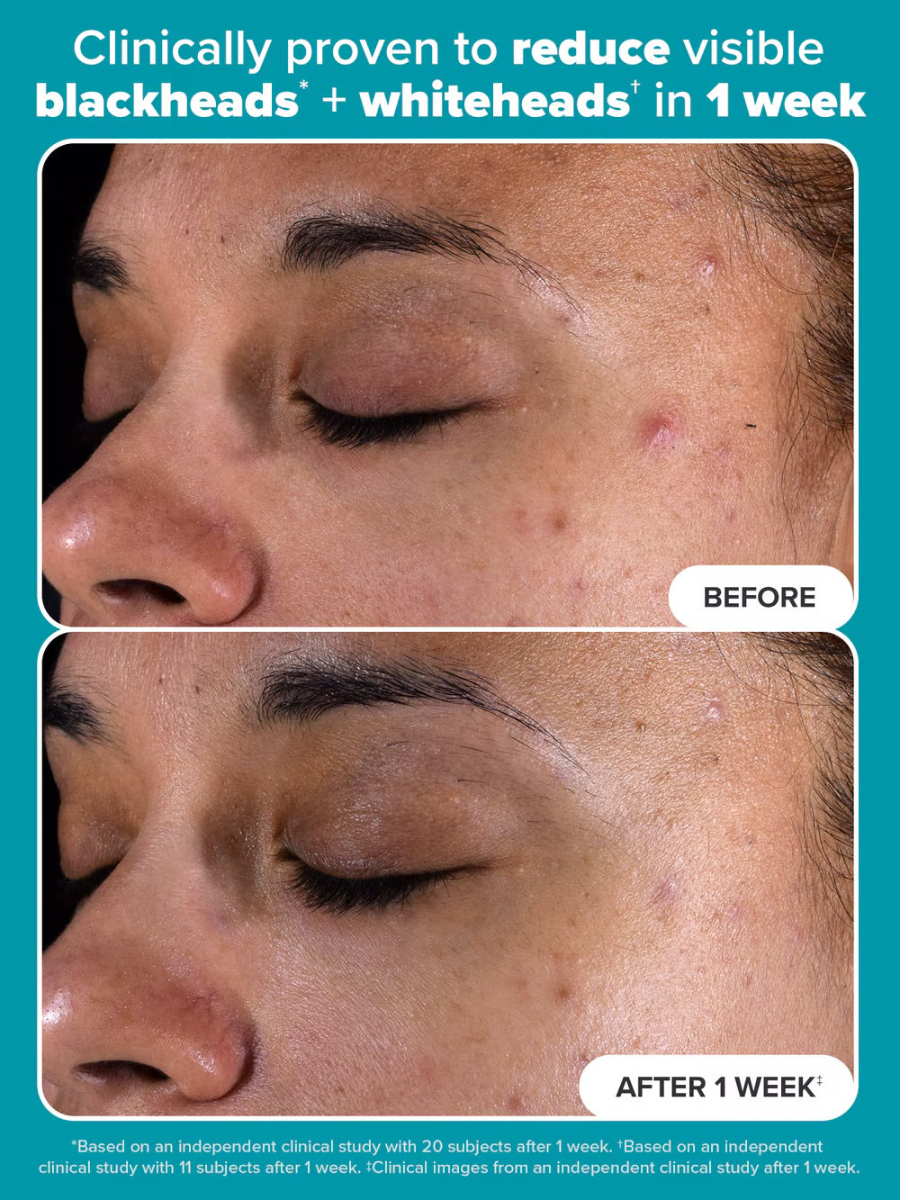 PAULA’S CHOICE 2% BHA Exfoliating Toner