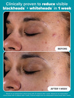 PAULA’S CHOICE 2% BHA Exfoliating Toner