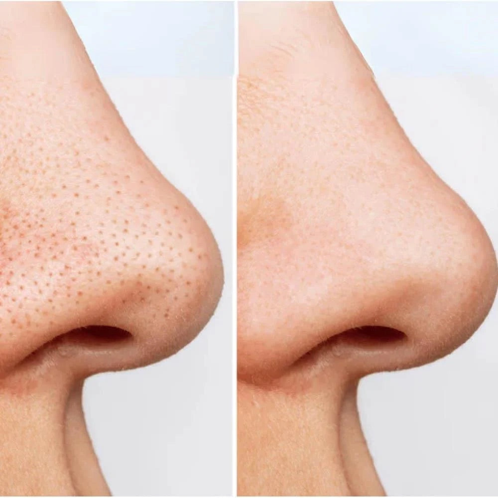 ANUA Heartleaf Pore Cleansing Oil