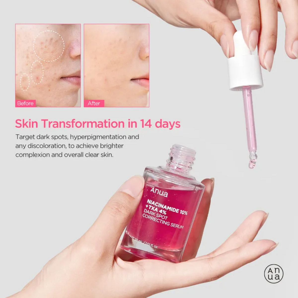 ANUA 10% Niacinamide + TXA 4% Sérum